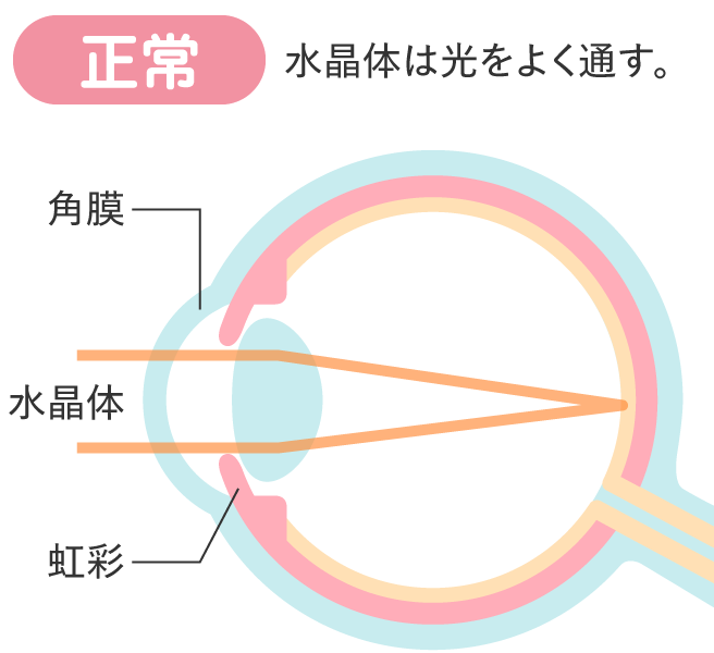 正常
